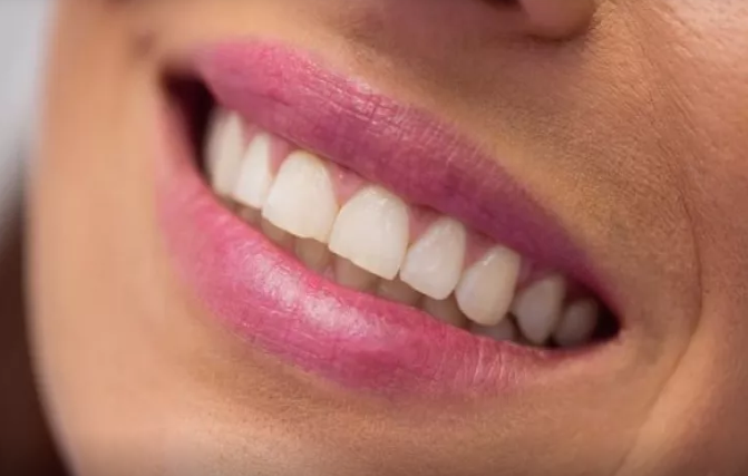 Dişlərinizin sağlam qalması üçün hər yeməkdən sonra bunları edin