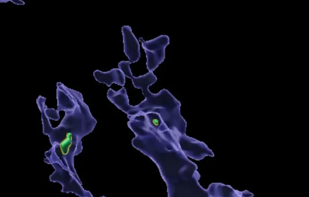 Alimlərdən mikroplastiklə bağlı YENİ TƏDQİQAT: İmmun sisteminə zərər vururmuş