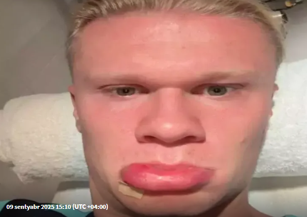 Qəzaya düşən Erlinq Haalandın son halını görənlər onu tanıya bilmir