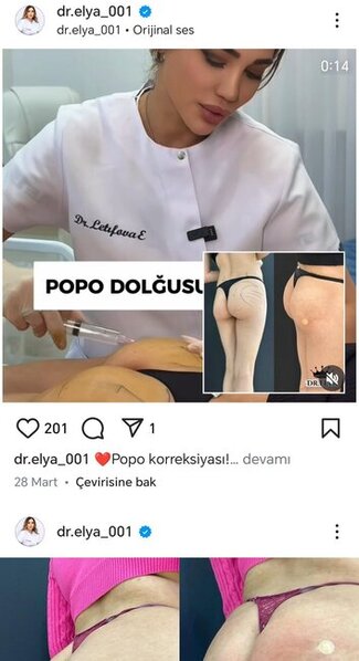 Estetik-həkim Elnarə Təhməzova qanunsuz fəaliyyət göstərir?