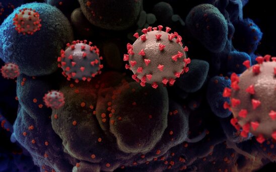 Həkim koronavirusdan sağalanlarda antikor yaranmasına nəyin mane olduğunu açıqlayıb
