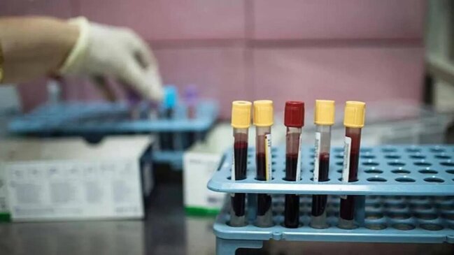 Xərçəngin bu növü Y nəslinin yeni kabusuna çevrilib