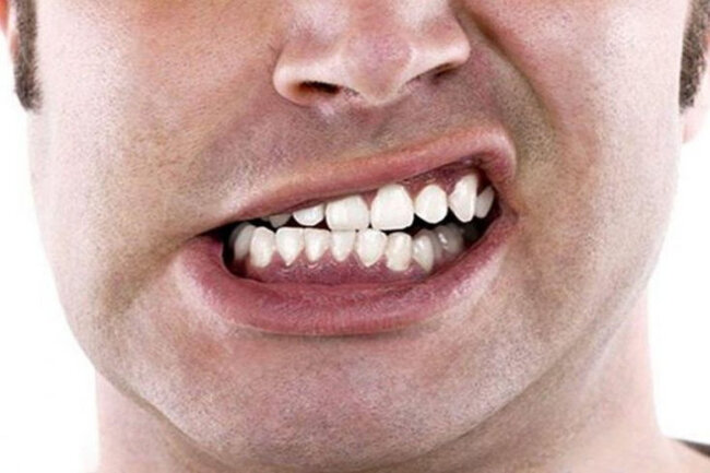 Dava zamanı kişinin gözünü və qulağını yedi - ağlasığmaz OLAY