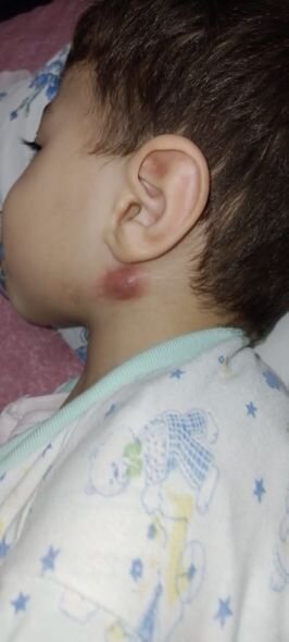 Üç yaşlı Yusifi xilas edək - FOTO