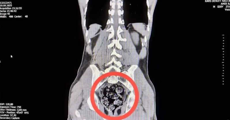 Kuryer narkotiki görün hansı üsulla daşıdı - VİDEO