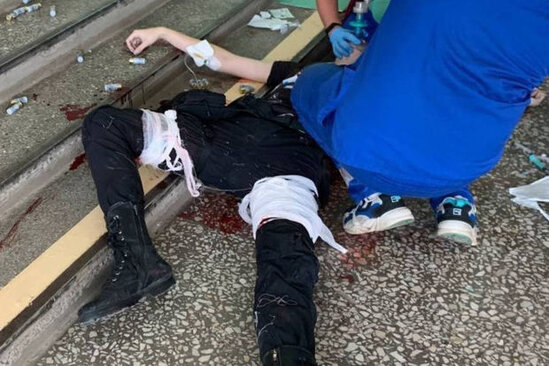 Perm universitetinə silahlı basqın edən şəxs öldürülüb? - YENİLƏNİB