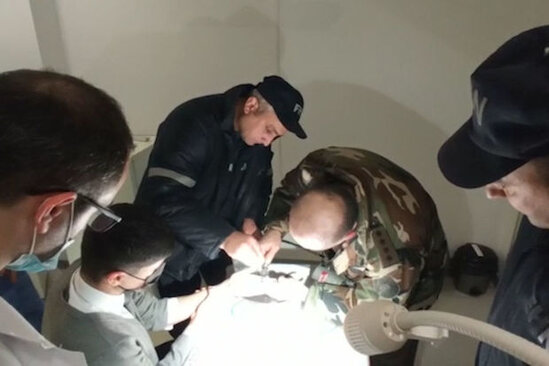 Xırdalan sakininin barmağında dəmir halqa qaldı - VİDEO