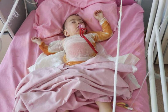 Bir yaşlı İnci anası süd qızdıran zaman yanıb - FOTO