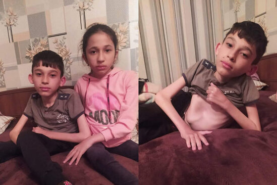 SMA xəstəsi olan bacı-qardaşın sizin köməyinizə ehtiyacı var – FOTO