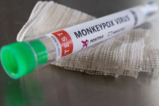 Gürcüstanda meymunçiçəyinə ilk yoluxma halı təsdiqləndi