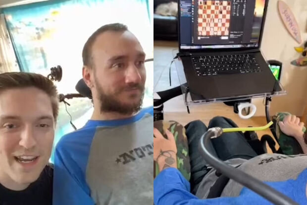 Maskın şirkətinin implant qoyduğu ilk xəstə uğurunu sərgilədi: Düşüncə gücü ilə şahmat oynadı - VİDEO