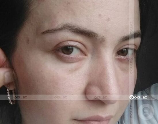 Polis əri tərəfindən şöbədə qətlə yetirilən qadının qardaşı gizlinləri açdı - FOTO