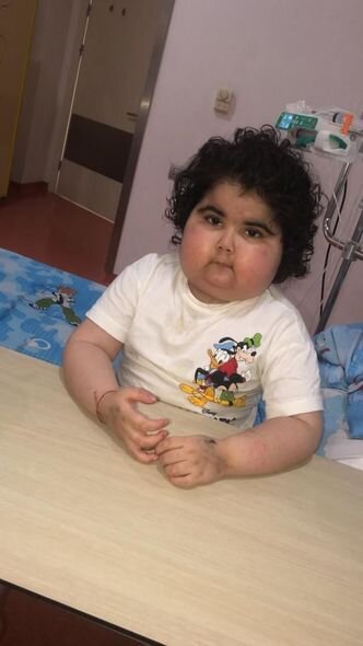 Ayan iki yaşından xərçənglə mübarizə aparır: Qolları göyərib, bədəni şişib - FOTO