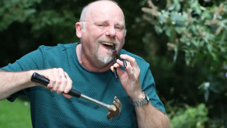 4 il həkimin qəbuluna düşə BİLMƏDİ: Kəlbətinlə dişini ÖZÜ ÇƏKDİ