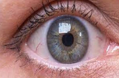 Gözlərimizi necə qoruya bilərik? - VACİB QAYDALAR