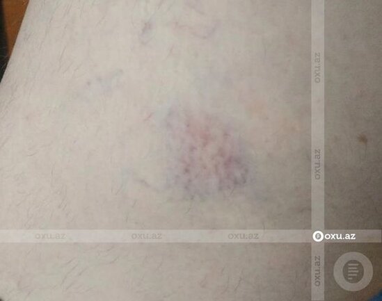 Polis əri tərəfindən şöbədə qətlə yetirilən qadının qardaşı gizlinləri açdı - FOTO