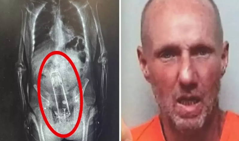 Yoxlanış zamanı həbsxanaya gətirilən şəxsin bədənində termos aşkarlandı