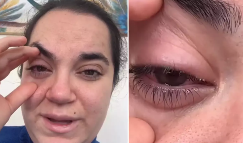 Qabyuyan maşın tableti əlində partlayan qadının gözündə ciddi problemlər yaranıb - VİDEO