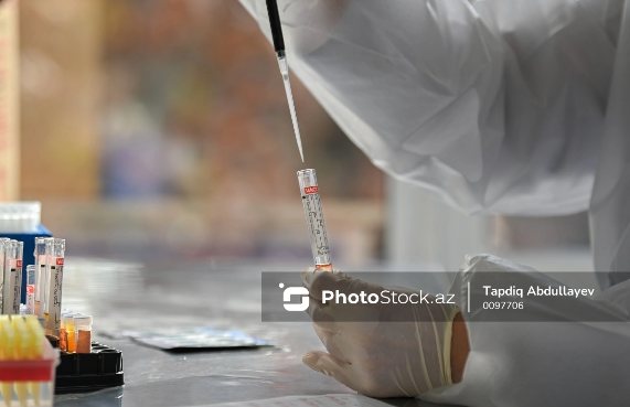 İnsan dərisindən yumurta hüceyrəsi yetişdirildi: Bioloji ana olmadan mayalanma mümkün ola bilər