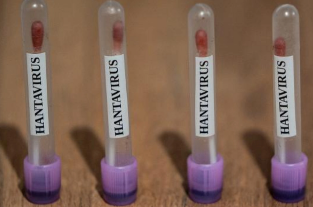 ABŞ hantavirus hallarını "3-cü səviyyə fövqəladə vəziyyət" kimi izləməyə başladı