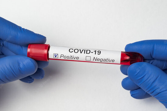 Məşhur müğənni koronavirusa yoluxdu - FOTO