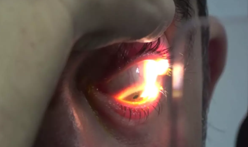 İnternat məktəbində qalmaqal: 8 şagirdin gözünə yuxuda yapışqan töküldü