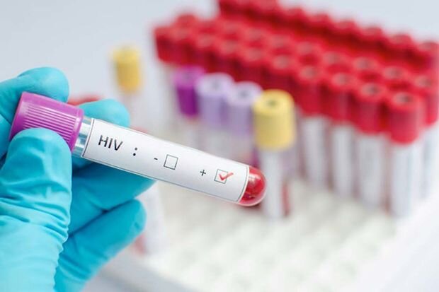 Hovuzdan ümumi istifadə zamanı QİÇS-ə yoluxmaq mümkündür? - AÇIQLAMA