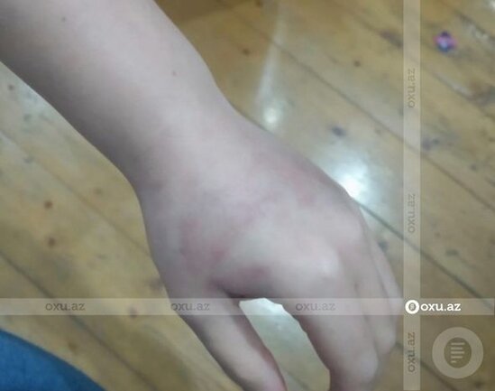 Polis əri tərəfindən şöbədə qətlə yetirilən qadının qardaşı gizlinləri açdı - FOTO