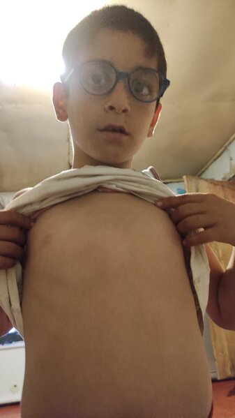 Humayə və övladının köməyinizə ehtiyacı var