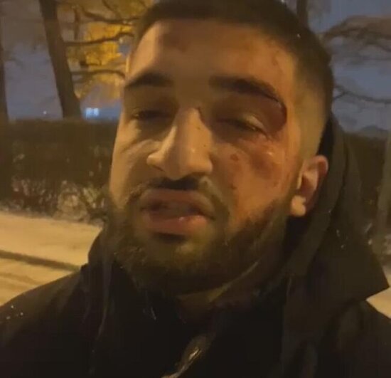 Azərbaycanlıları təhqir edən ermənini üzr istəməyə məcbur etdilər - Video yayıb yalvardı