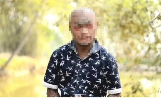 "İlan adam" peyda oldu: Hər həftə dərisi dəyişir