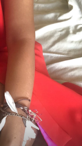 İlqarə Kazımova yataqda qırımızı əlbisədə ayaqlarını göstərdi - FOTO