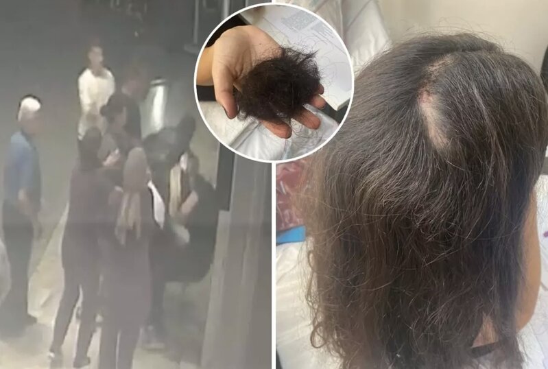 Həkim xəstənin yaxınları tərəfindən döyüldü