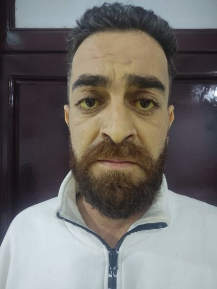 Xoşqədəm Hidayətqızı "Ata Ocağı" serialının aktyoru, sirrozdan əziyyət çəkən Elvin Ağayevə dəstək oldu-VİDEO