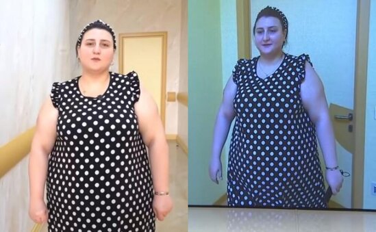 Xalq artistinin bacısı qızı efirə gəlib yardım istədi-FOTO