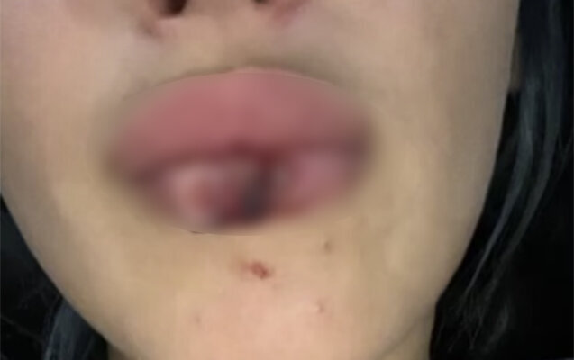 "Əllərimi və dodağımı özüm yandırmışam" deyib ərini bağışladı