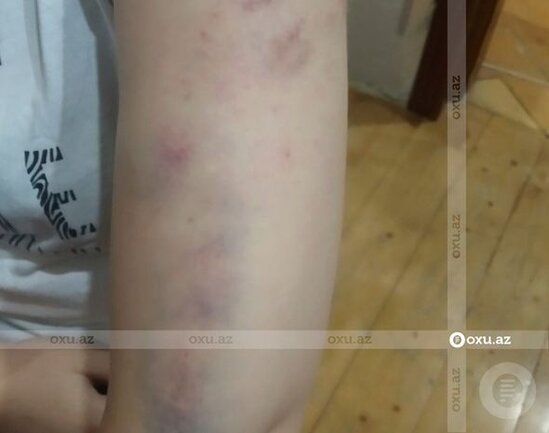 Polis əri tərəfindən şöbədə qətlə yetirilən qadının qardaşı gizlinləri açdı - FOTO