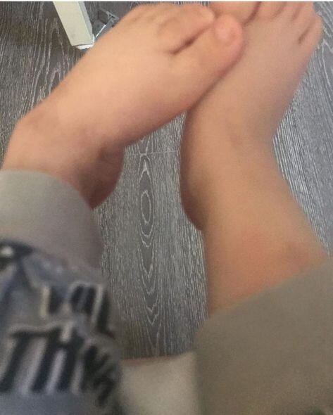 Beş yaşlı qızın sağlam böyrəyinin xilas olunmasına kömək edin - Yardım ÇAĞIRIŞI + FOTO