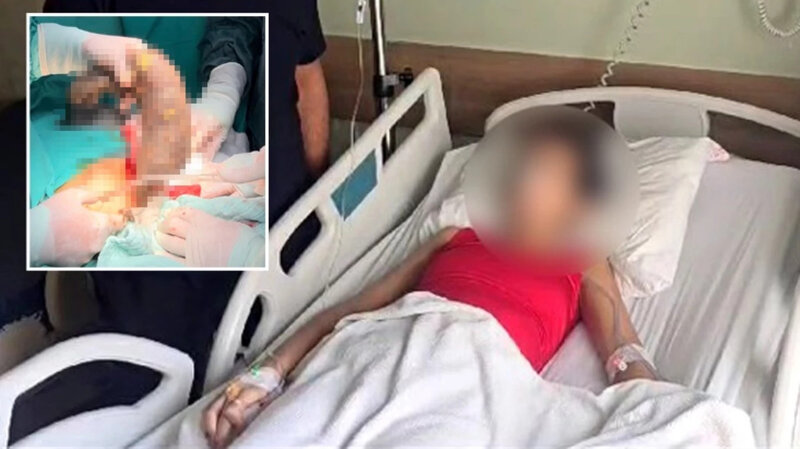 Qadının mədəsindən çıxanlara həkim belə inana BİLMİR - Tam 50 santimetr UZUNLUĞUNDA... FOTO+VİDEO