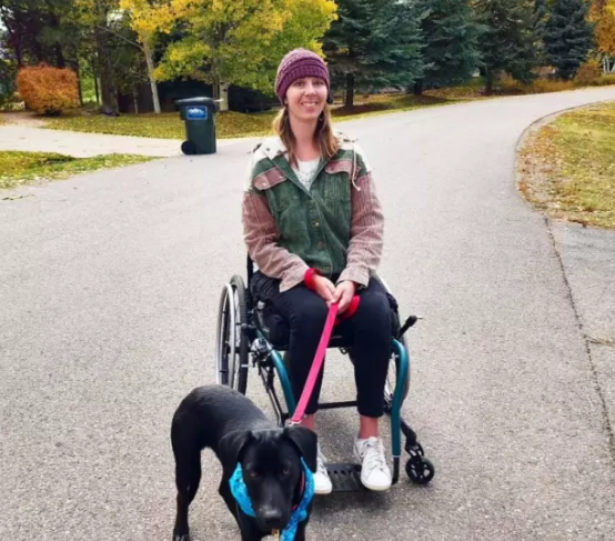 Kəllə sümüyü onurğasından ayrılmaq üzrə idi: 37 əməliyyat keçirtdi - FOTO