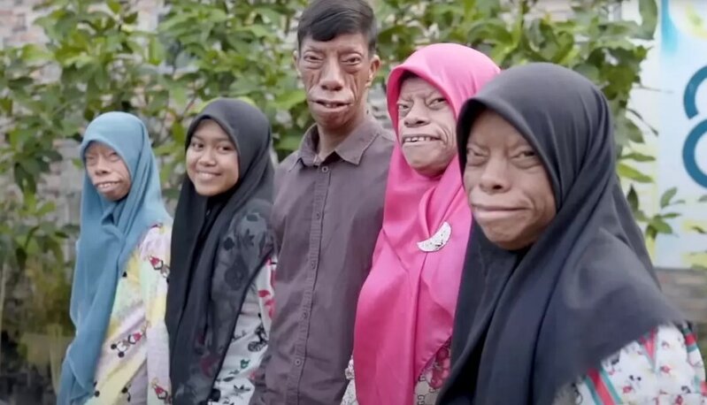 Dünya onları danışır: "Kərtənkələ ailəsi" qısa zamanda fenomenə çevrildi - VİDEO