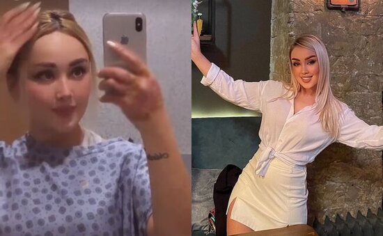 Partlayışda yaralanan modelin xəstəxanadan görüntüsü - VİDEO