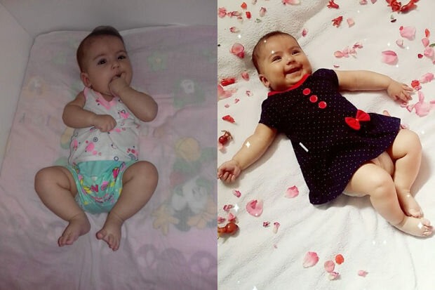 Başında kista olan səkkiz aylıq körpənin yardıma ehtiyacı var - FOTO