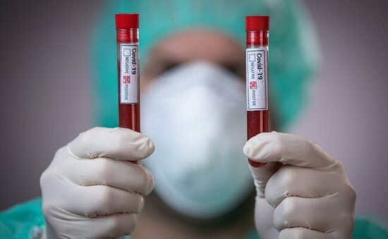 Yoluxanların bu günə olan sayı