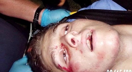 Adamyeyən tələbə ərlə arvadı öldürdü, kişini gəmirdi - FOTO