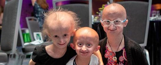 28 fevral – Beynəlxalq Nadir Xəstəliklər Günüdür