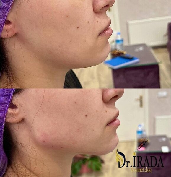 Heç şübhəniz olmasın, gözəlliyiniz etibarlı əllərdədir! - FOTOLAR