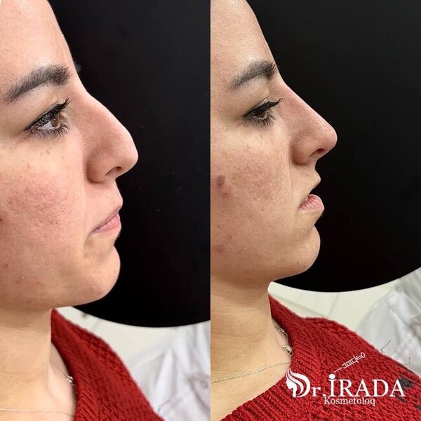 Heç şübhəniz olmasın, gözəlliyiniz etibarlı əllərdədir! - FOTOLAR