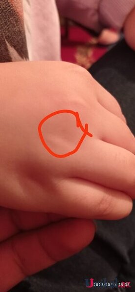 Məktəbdə tükürpədici olay: İki azyaşlı şagirdə iynə vurulurmuş (İDDİA)