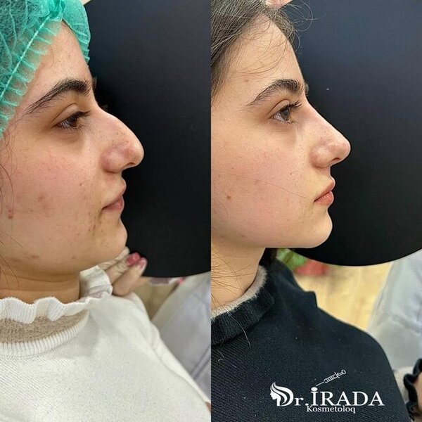 Heç şübhəniz olmasın, gözəlliyiniz etibarlı əllərdədir! - FOTOLAR